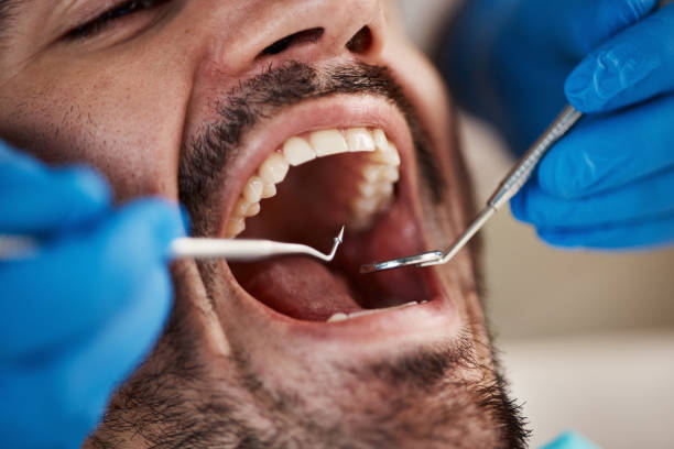 Best Emergency Treatment for Toothache in Albertson, NY